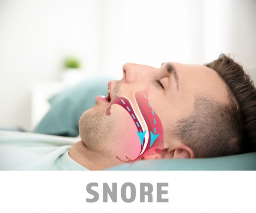 Diagnosis – Snoring causes